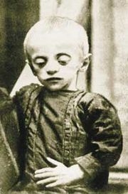 Copil victima a foametei din 1932-1933 din Ucraina, cunoscută ca Holodomor. 