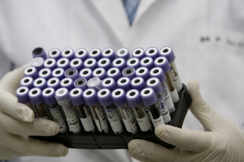 Probe pentru testarea ADN-ului (JOSEPH EID / AFP / Getty Images)