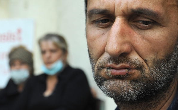 Ramaz Aronia, un refugiat de 51 de ani din Abkhazia, participa alaturi de alti zeci de refugiati la o greva a foamei in Tbilisi impotriva deciziei guvernului de a-i evacua din casele in care locuiau, 27 august 2010. (VANO SHLAMOV / AFP / Getty Images)