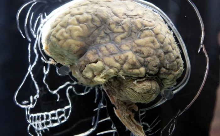 Un creier uman la Expozitia "Real Brain" din Bristol, Anglia.