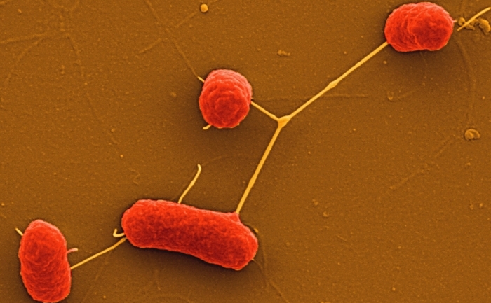Bacteria E. coli (HZI / Getty Images)