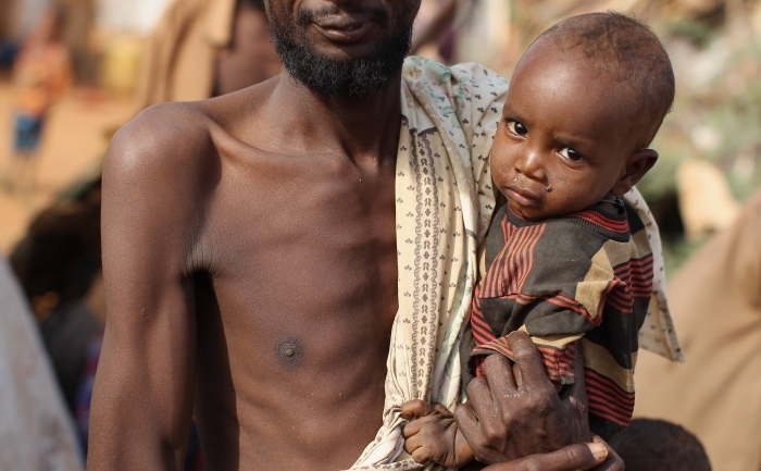 Refugiati somalezi in lagarul de refugiati de la Dadaab, Kenya, 22 iulie 2011