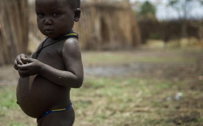 Copil suferind de malnutritie in Moroto, Africa