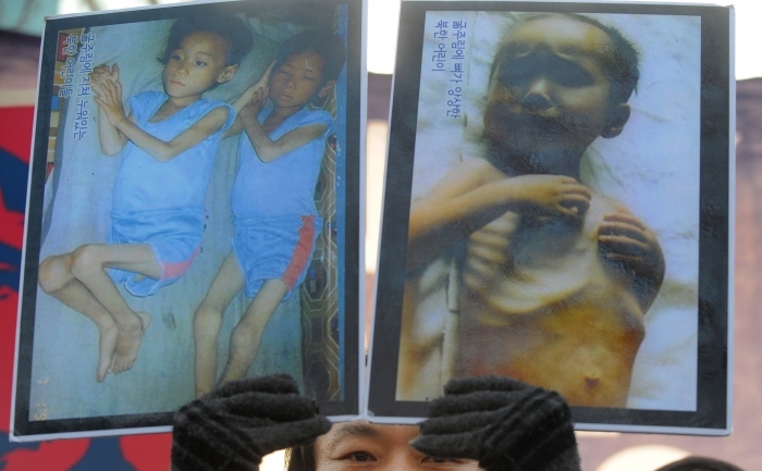 Un activist sud-coreean afişează poze cu copii nord-coreeni subnutriţi.