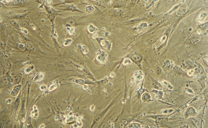 Celule stem embrionare văzute la microscop.