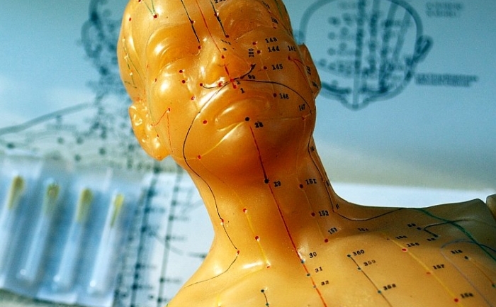Medicii care practică acupunctura trebuie să poată vedea corpul uman prin "ochelari cuantici" pentru a putea înţelege acest sistem antic de tratament (Credit: Cat Rooney / The Epoch Times)