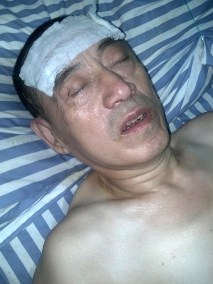 Li Hongkui, un aderent Falun Gong din Harbin, a murit în spital în august 2012, ca urmare a bătăilor primite de la gardienii închisorii unde se afla încarcerat