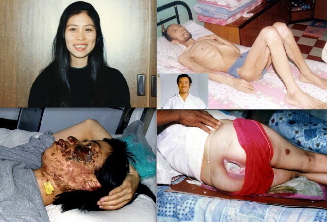 Tortura practicanţilor Falun Gong