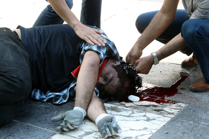 Demonstrant turc rănit de pe urma ciocnirilor cu poliţia, Ankara, 1 iunie 2013