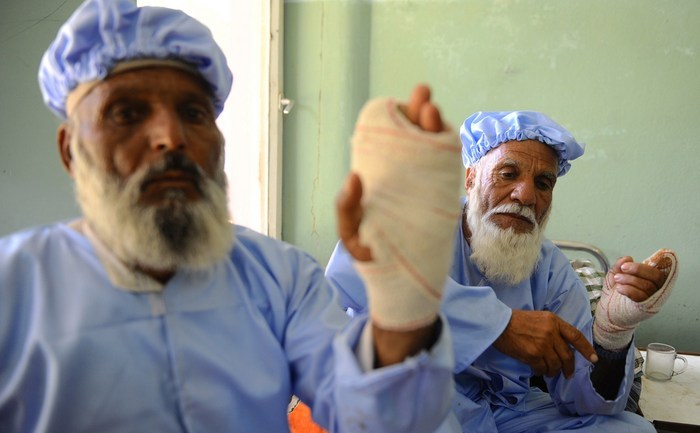 Afgani cu degetele tăiate de talibani, drept pedeapsă pentru că au votat. 15 iunie 2014, Herat