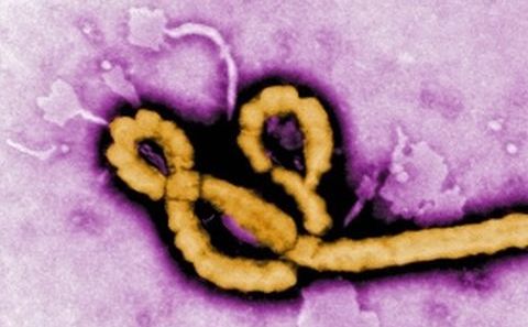 Virusul Ebola, la microscop.