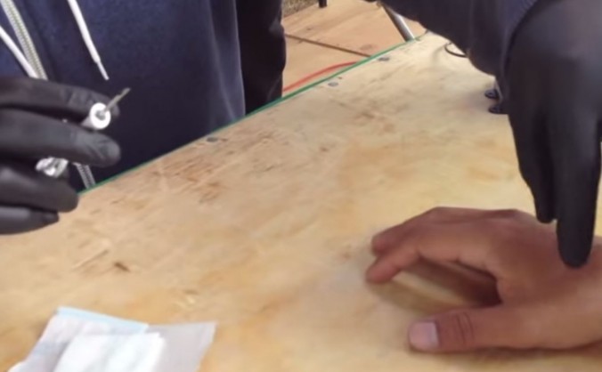 Procesul implantării unui microcip RFID în mâna unui bărbat. (YouTube Screenshot)