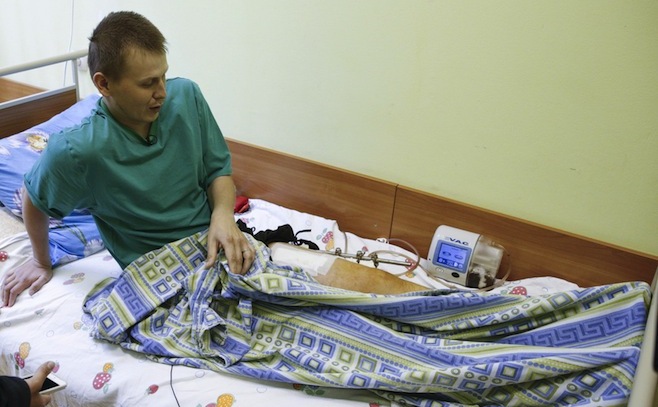 Alexander Alexandrov susţine un interviu într-un spital din Kiev, 28 mai 2015.