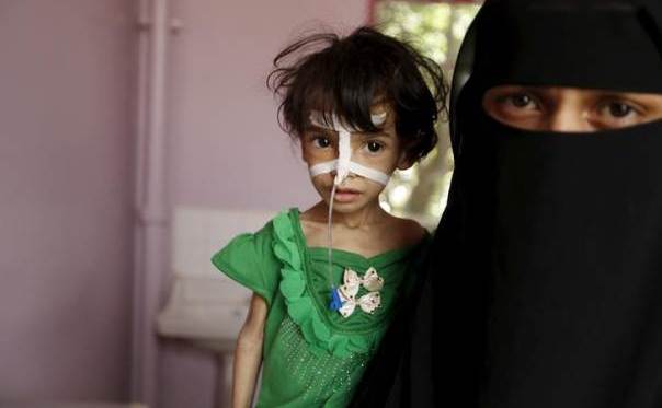O mamă stă lângă fiica sa subnutrită într-un spital din capitala yemenită Sana’a, 28 iulie 2015. (Captură Foto)