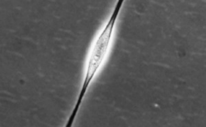 Aceasta fotografie furnizata de Institutul de Cercetari in Celule Stem,  infatiseaza o singura celula stem, care poate "produce" toate tipurile  de celule ale sistemului nervos.