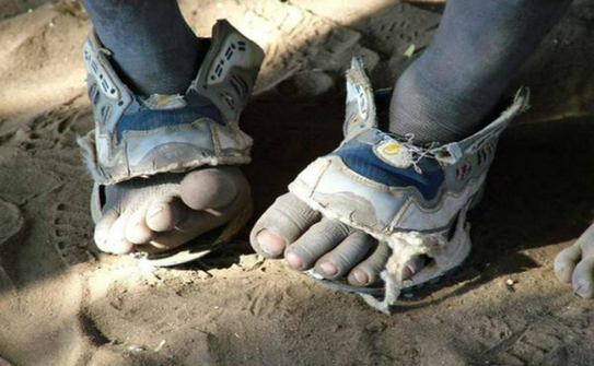 Statisticile arată că peste 300 de milioane de copii suferă de o serie de boli datorită faptului că nu poartă pantofi sau merg desculţi. (Google.com)