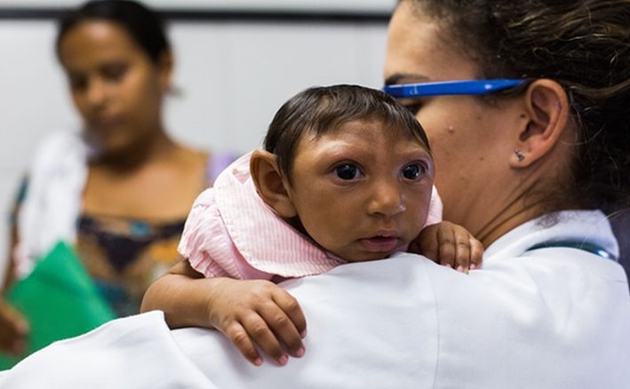 Un copil născut în Brazilia la începutul lui 2016, suferind de microcefalie. S-a constatat o legătură strânsă între virusul Zika şi această boală.