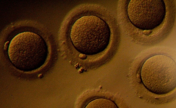 Embrioni umani - SUA - La Jolla IVF Lab