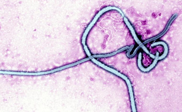 Virusul Ebola, la microscop