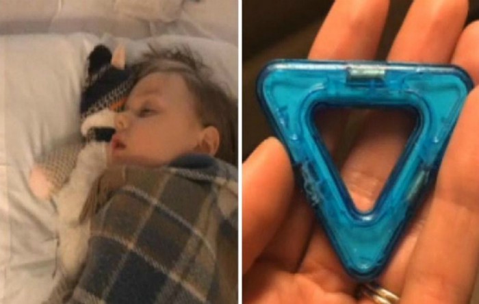 Bucăţi din colonul unui băieţel au fost înlăturate în urma înghiţirii unor magneţi jucărie, declară mama acestuia (captură video Fox News)
