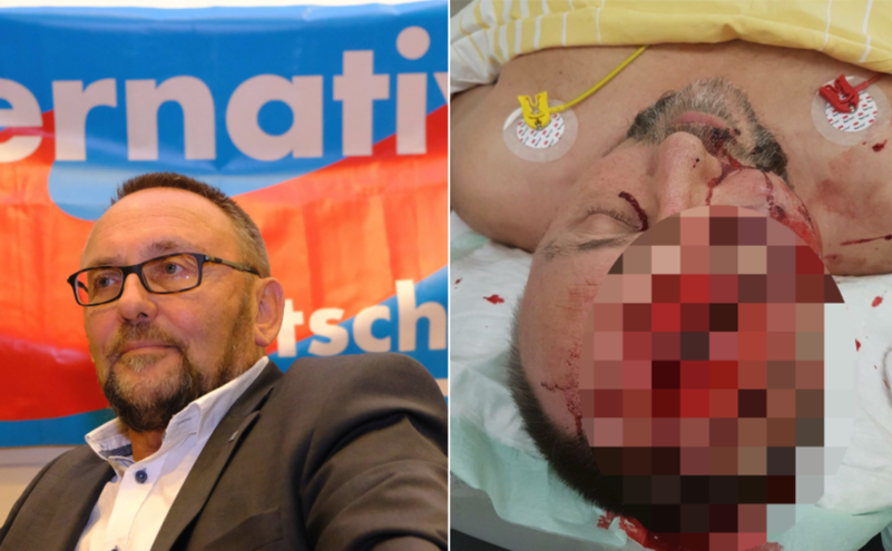 Peşedintele Afd Frank Magnitz linşat în cadrul unui incident bizar