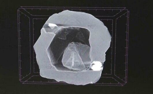 X-ray (Alrosa)