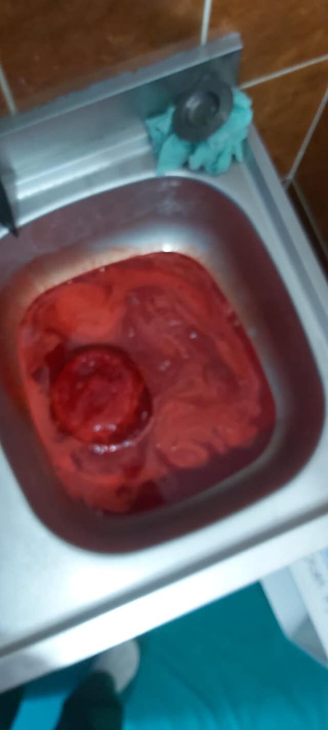Sange contaminat trimis in reteaua de canalizare a Bucurestiului (Facebook - Emanuel Ungureanu)
