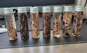 Cheaguri fibroase găsite în cadavre (Prin amabilitatea lui Richard Hirschman)