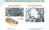 Mitocondrii defecte în celule canceroase (Health 1+1 / The Epoch Times)