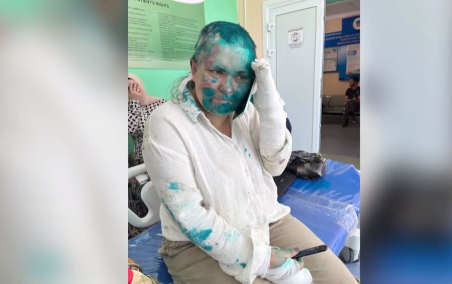 Yelena Milashina, cunoscută jurnalistă a ziarului Novaya Gazeta, după ce a fost atacată de oameni înarmaţi