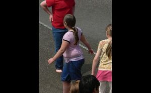 Obezitate (Wikipedia.org)